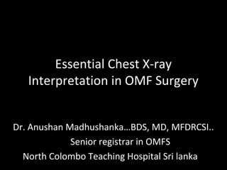 Essential Chest X-ray
Interpretation in OMF Surgery
Dr. Anushan Madhushanka…BDS, MD, MFDRCSI..
Senior registrar in OMFS
North Colombo Teaching Hospital Sri lanka
 