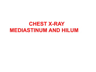 CHEST X-RAY
MEDIASTINUM AND HILUM
 