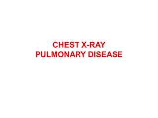 CHEST X-RAY
PULMONARY DISEASE
 