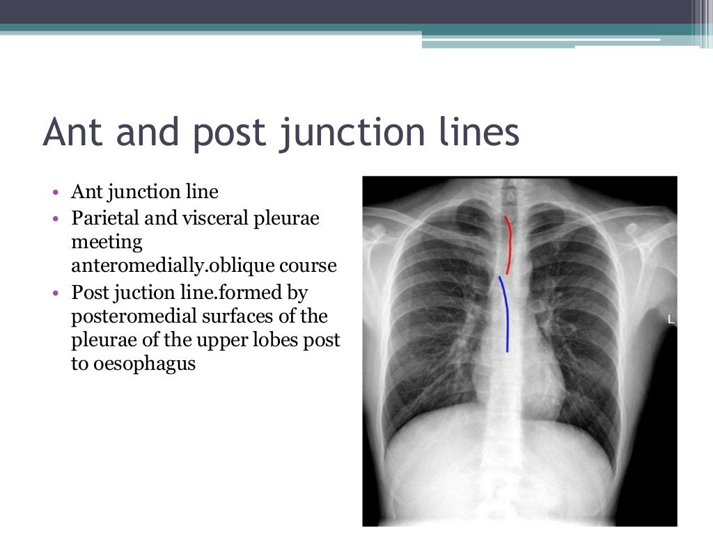 Chest x ray positioning
