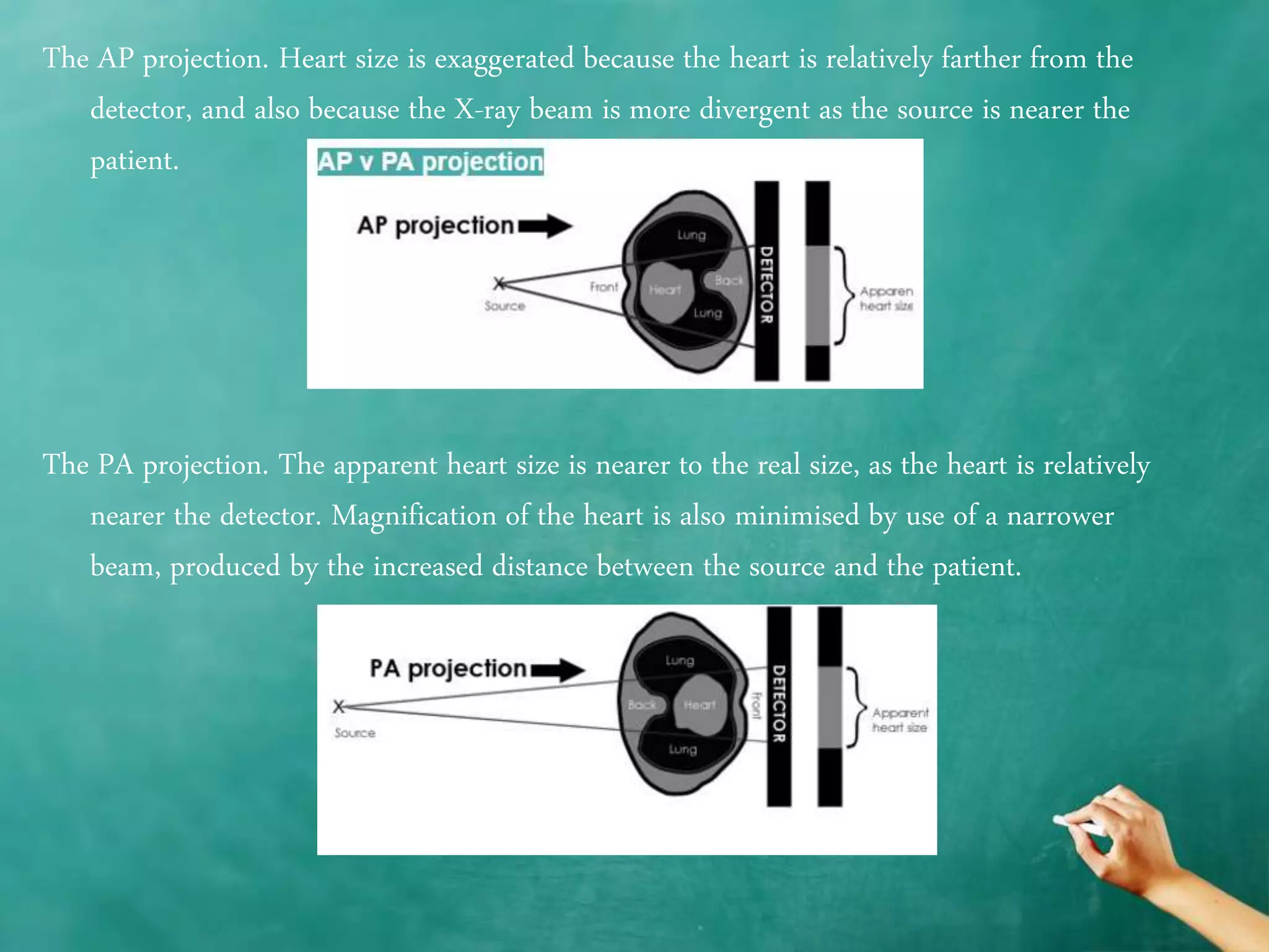 Chest x ray quality - how to interpret chest x-ray (1) | PPTX
