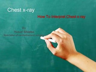 Chest x-ray
How To Interpret Chest x-ray
By
Yusuf Shieba
Specialist of cardiothoracic surgery
 