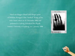 Chest x ray quality - how to interpret chest x-ray (1) | PPTX