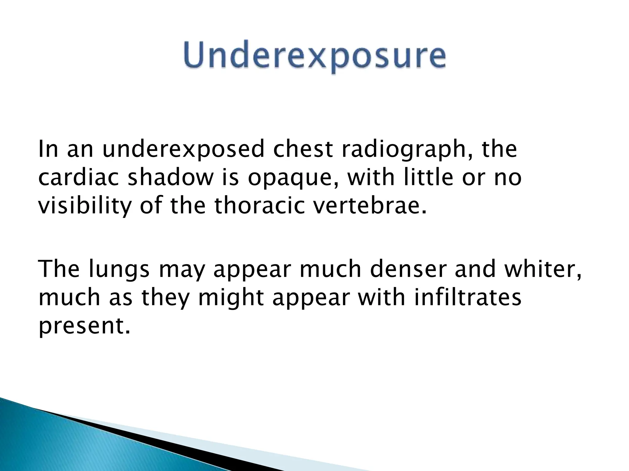 Chest X-ray radiology_Power Point Presentation | PPTX