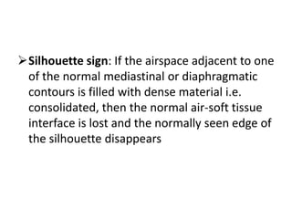 Silhouette sign: If the airspace adjacent to one
 of the normal mediastinal or diaphragmatic
 contours is filled with dense material i.e.
 consolidated, then the normal air-soft tissue
 interface is lost and the normally seen edge of
 the silhouette disappears
 