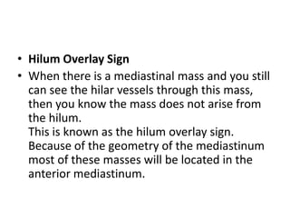 • Hilum Overlay Sign
• When there is a mediastinal mass and you still
  can see the hilar vessels through this mass,
  then you know the mass does not arise from
  the hilum.
  This is known as the hilum overlay sign.
  Because of the geometry of the mediastinum
  most of these masses will be located in the
  anterior mediastinum.
 