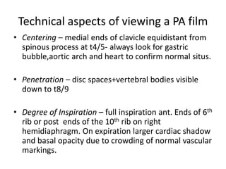 Technical aspects of viewing a PA film
• Centering – medial ends of clavicle equidistant from
  spinous process at t4/5- always look for gastric
  bubble,aortic arch and heart to confirm normal situs.

• Penetration – disc spaces+vertebral bodies visible
  down to t8/9

• Degree of Inspiration – full inspiration ant. Ends of 6th
  rib or post ends of the 10th rib on right
  hemidiaphragm. On expiration larger cardiac shadow
  and basal opacity due to crowding of normal vascular
  markings.
 
