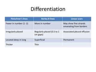Differentiation
     Fleischner’s lines           Kerley B lines               Linear scars
Fewer in number (1 -2)     More in number               May show fine strands
                                                        emanating from borders

Irregularly placed         Regularly placed (0.5 to 1   Associated pleural effusion
                           cm gaps)

Located deep in lung       Superficial                  Permanent
Thicker                    Thin
 
