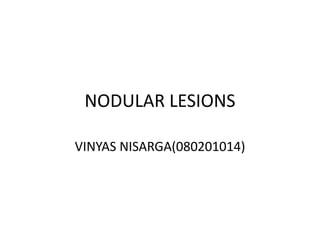 NODULAR LESIONS

VINYAS NISARGA(080201014)
 