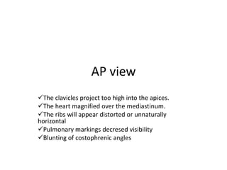 AP view
The clavicles project too high into the apices.
The heart magnified over the mediastinum.
The ribs will appear distorted or unnaturally
horizontal
Pulmonary markings decresed visibility
Blunting of costophrenic angles
 