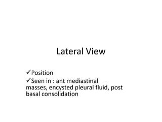 Lateral View

Position
Seen in : ant mediastinal
masses, encysted pleural fluid, post
basal consolidation
 
