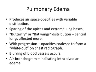 Pulmonary Edema
• Produces air space opacities with variable
  distribution.
• Sparing of the apices and extreme lung bases.
• “Butterfly” or “Bat wings” distribution – central
  lungs affected more.
• With progression – opacities coalesce to form a
  “white-out” on chest radiograph.
• Blurring of blood vessels occurs.
• Air bronchogram – indicating intra alveolar
  edema.
 