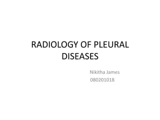 RADIOLOGY OF PLEURAL
      DISEASES
           Nikitha James
           080201018
 