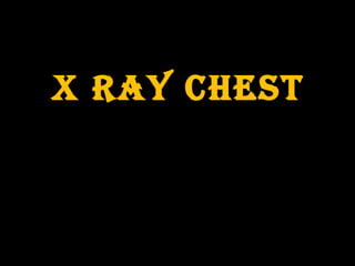 X RAY CHEST
 