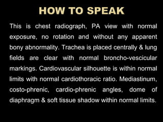 This is chest radiograph, PA view with normal
exposure, no rotation and without any apparent
bony abnormality. Trachea is placed centrally & lung
fields are clear with normal broncho-vescicular
markings. Cardiovascular silhouette is within normal
limits with normal cardiothoracic ratio. Mediastinum,
costo-phrenic, cardio-phrenic angles, dome of
diaphragm & soft tissue shadow within normal limits.
 