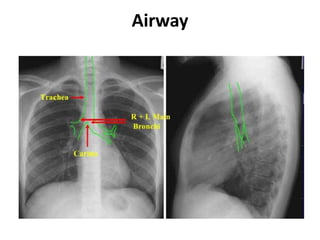 Airway
 