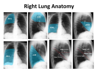 Right Lung Anatomy
 
