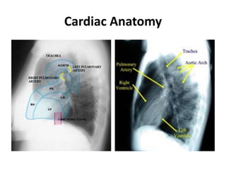 Cardiac Anatomy
 