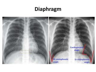 Diaphragm
 