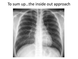 To sum up…the inside out approach
 