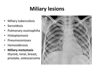Miliary lesions
• Miliary tuberculosis
• Sarcoidosis
• Pulmonary eosinophilia
• Histoplasmosis
• Pneumoconioses
• Hemosiderosis
• Miliary metastasis
thyroid, renal, breast,
prostate, osteosarcoma
 