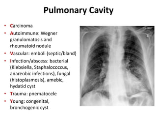 Pulmonary Cavity
• Carcinoma
• Autoimmune: Wegner
granulomatosis and
rheumatoid nodule
• Vascular: emboli (septic/bland)
• Infection/abscess: bacterial
(Klebsiella, Staphalococcus,
anareobic infections), fungal
(histoplasmosis), amebic,
hydatid cyst
• Trauma: pnematocele
• Young: congenital,
bronchogenic cyst
 