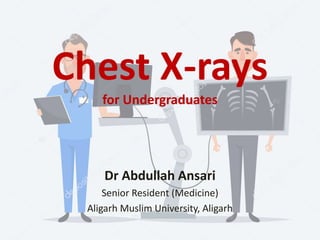 Chest X-rays
for Undergraduates
Dr Abdullah Ansari
Senior Resident (Medicine)
Aligarh Muslim University, Aligarh
 