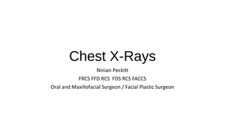 Chest X-Rays
Ninian Peckitt
FRCS FFD RCS FDS RCS FACCS
Oral and Maxillofacial Surgeon / Facial Plastic Surgeon
 