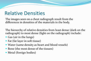 Chest x ray | PPTX