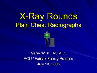 X-Ray Rounds
Plain Chest Radiographs
Garry W. K. Ho, M.D.
VCU / Fairfax Family Practice
July 13, 2005
 