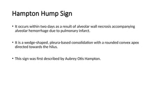 Chest x-ray INTERPRETATION AND signs.pptx