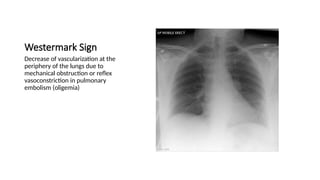 Watermark Sign Radiology Chest x-ray INTERPRETATION AND signs.pptx