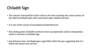 Chest x-ray INTERPRETATION AND signs.pptx