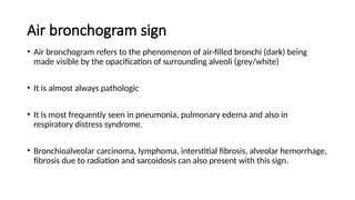 Chest x-ray INTERPRETATION AND signs.pptx