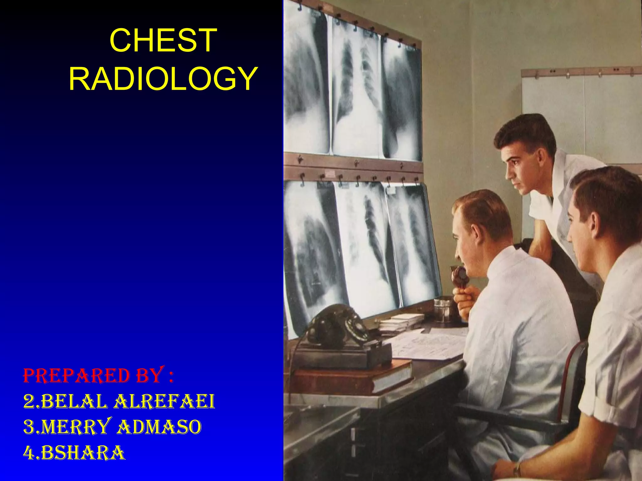 Chest xray PPT