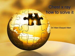 Chest x ray
how to solve it
Dr/ Allam Elsayed Allam
 