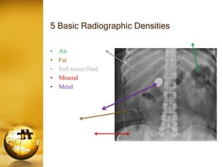 Chest x ray basic knowledge | PPTX