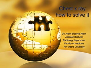 Chest x ray
how to solve it
Dr/ Allam Elsayed Allam
Assistant lecturer
Radiology department
Faculty of medicine
Ain shams university
 