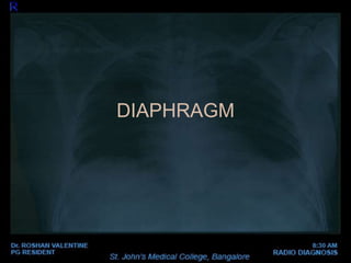DIAPHRAGM
 