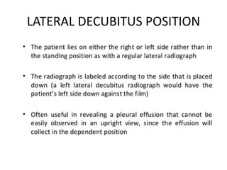 LATERAL DECUBITUS POSITION
 