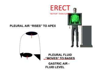 ERECT
“BETTER” THAN SUPINE
PLEURAL FLUID
“MOVES” TO BASES
GASTRIC AIR -
FLUID LEVEL
PLEURAL AIR “RISES” TO APEX
 