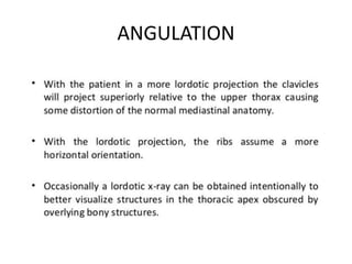 ANGULATION
 