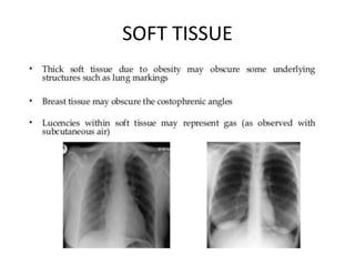SOFT TISSUE
 