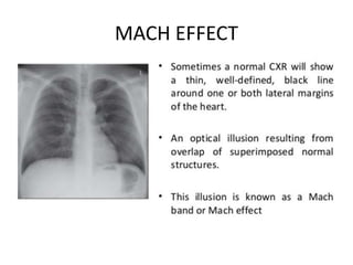 MACH EFFECT
 