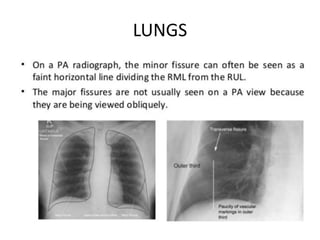 LUNGS
 