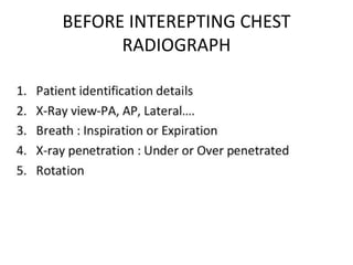 BEFORE INTEREPTING CHEST
RADIOGRAPH
 