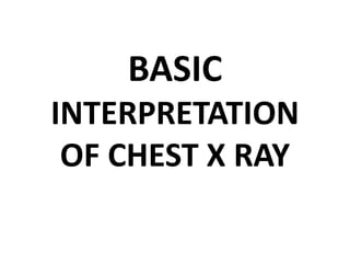 BASIC
INTERPRETATION
OF CHEST X RAY
 