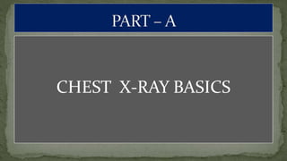 CHEST X-RAY BASICS
 