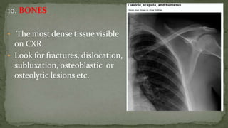 10. BONES
• The most dense tissue visible
on CXR.
• Look for fractures, dislocation,
subluxation, osteoblastic or
osteolytic lesions etc.
 