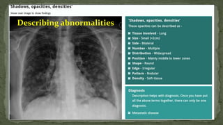 Describing abnormalities
 
